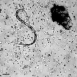 Nuestro sistema inmunológico en acción