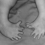 Cameron presiona a Alemania para actuar contra el escándalo de la Talidomida