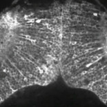 Japoneses capturan en video la creación de un pensamiento en el cerebro