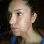 Mi marido me pega lo normal*. Cuando me lo merezco. Como la novia de Rubén Castro