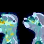 Nueva técnica permite ver en qué partes del cuerpo se oculta el virus del sida (ING)