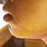 La Guardia Civil indemnizará a la niña de cinco años herida con una pelota de goma