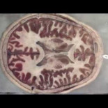 En el interior del cerebro humano. Sección transversal de la cabeza completa