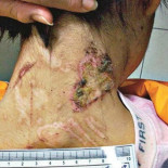 Descubren en México DF caso de esclavitud