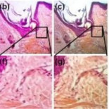 Una lente que convierte el móvil en un microscopio y cuesta 3 céntimos [Inglés]