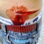 Dos neonazis apuñalan a un joven en Valladolid