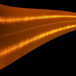 Estrechando el cerco en torno a donde en el cerebro se originan los sonidos fantasma del tinnitus