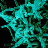 Detectado en Olot el primer caso de difteria en España desde 1987 [CAT]