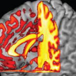 Se han encontrado enlaces entre el tipo de sangre y el riesgo de deterioro cognitivo