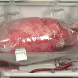 Estas cajas permiten que los pulmones que se van a trasplantar sigan en funcionamiento durante su transporte