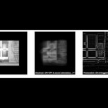 ¿Cómo ve el mundo alguien con un ojo biónico? (ING)