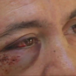 El "sin techo" agredido en Granada fue apaleado por la música que escuchaba