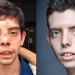 Cuatro desconocidos propinan una paliza al actor Javier Bódalo