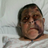 El Cunqueiro da 2 horas a la familia de este hombre, que sufre una rotura de pelvis, para que se lo lleve del hospital