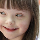 Una esperanza para los afectados por el Síndrome de Down