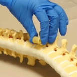 Un nuevo polímero para sustituir vértebras dañadas