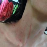 Patadas, puños y arañazos: las chicas del Cáceres relatan su pesadilla en Córdoba