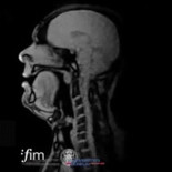 Resonancia magnética en tiempo real grabando a cantante de ópera. [ENG]