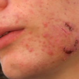 Un menor recibe una paliza por defender a una maltratada