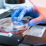 La inmunoterapia abre la puerta a una vacuna universal contra el cáncer