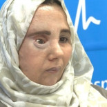 El antes y el después de Samira, la mujer a la que el doctor Cavadas cambió la cara