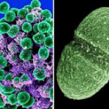 Akkermansia, la deseada bacteria adelgazante