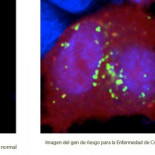 Desvelado uno de los mecanismos moleculares implicados en la enfermedad de Crohn