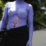 “Murió con el feto adentro porque la ley contra el aborto no nos permitió darle el tratamiento contra su cáncer"