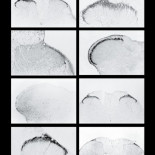 En busca de un fármaco que alivie el dolor del mundo sin crear drogadicción