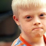 La prueba médica que podría acabar con el síndrome de Down (y por qué algunos no quieren que eso ocurra)