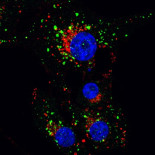 Un cannabinoide acaba con células tumorales gracias al ‘reciclaje’ celular