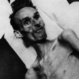 Las inesperadas enseñanzas que nos dejó la hambruna causada por los nazis en Holanda