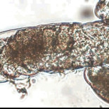 Observan por primera vez a un tardígrado teniendo sexo... durante una hora (ING)