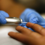 Alarma en un instituto después de que 23 niños se sometieran al test de glucosa con la misma aguja