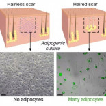 Científicos descubren cómo curar heridas sin dejar cicatriz