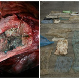 Esto es lo que había en el estómago de una ballena [NO]