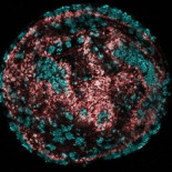 Posible tratamiento farmacológico para regenerar las células ciliadas del oído interno