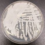 ¿Puede un hongo ser la causa de una alerta sanitaria mundial? Candida auris lo es