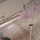 A falta de bolsas de acumulación de orina conectan el paciente al retrete