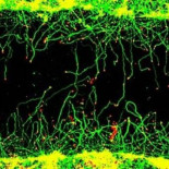 Sustancia capaz de reparar axones dañados de neuronas