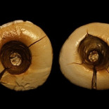 Evidencias de empastes dentales durante la Edad de Hielo