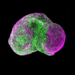 Un prosencéfalo humano en gestación en una placa de Petri (ING)