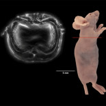 Lásers crean ondas sonoras que permiten ver órganos vivos en acción (ING)