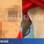 Una denuncia con 1.500 firmas destapa años de acoso en un colegio de Madrid