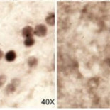 Utilizan la técnica CRISPR para revertir la enfermedad de Huntington en ratones