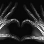 Radiografías que no debe fallar ningún médico [ENG]