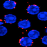 Nuevo modelo para proteger el cuerpo de enfermedades autoinmunes