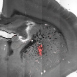 Estimulan remotamente el cerebro con campos magnéticos y controlan los movimientos del cuerpo [EN]