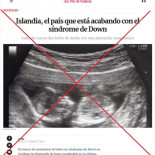 Mitos islandeses: en Islandia no están acabando con el síndrome de Down
