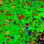 Podríamos haber descubierto finalmente el detonante que inicia las enfermedades autoinmunes [ENG]